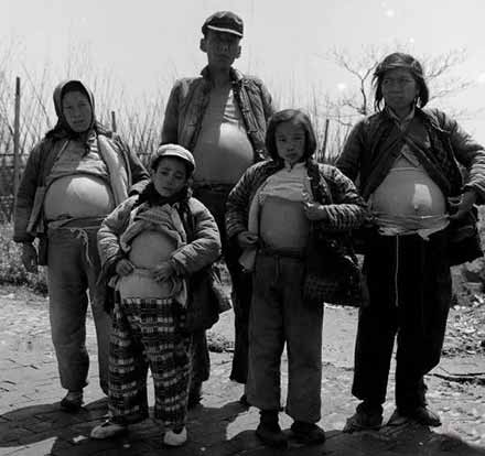 70年 | 永不停歇的战斗:中国疾病防治70年