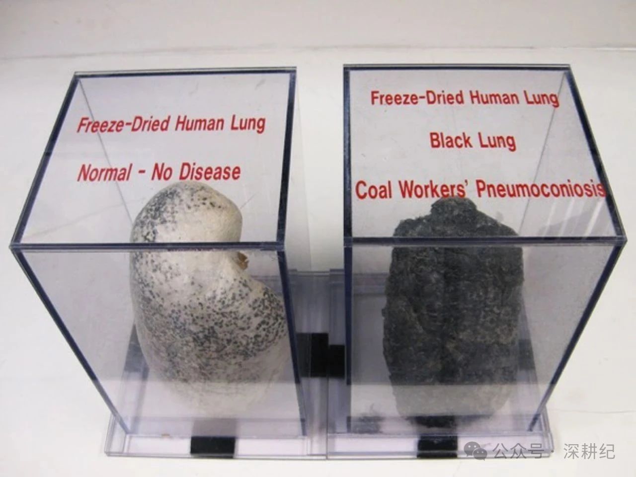 黑肺病2.jpg
